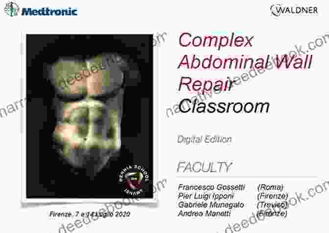 Cover Of Manual Of Complex Abdominal Wall Reconstruction Manual Of Complex Abdominal Wall Reconstruction